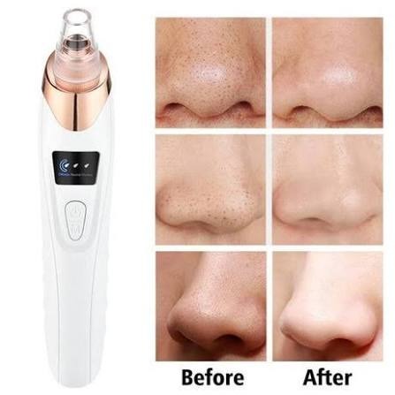 USB Rechargeable Facial Skin Care Device